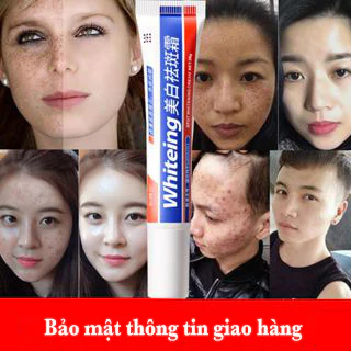 「🔥Đảm bảo xác thực」Serum trắng da kem nám tàn nhang chăm sóc da mặt 20g loại bỏ nám làm sáng tông màu da