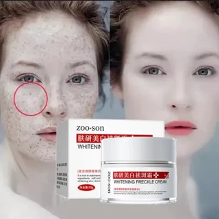 kem xóa nám làm trắng da tinh chất Niacinamide kem dưỡng da mặt chất da làm mờ tàn nhang có hiệu quả/50g