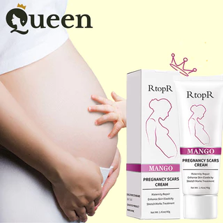 Kem dưỡng  RtopR mango pregnancy scars cream 40g Phòng ngừa và làm mờ vết rạn da, vết béo phì