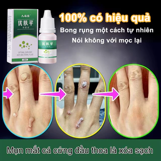 (10ml) Serum mụn cóc loại bỏ mụn cơm, gel mụn cóc, mụn mắt cá, tẩy nốt ruồi, tẩy mụn ruồi 10ML