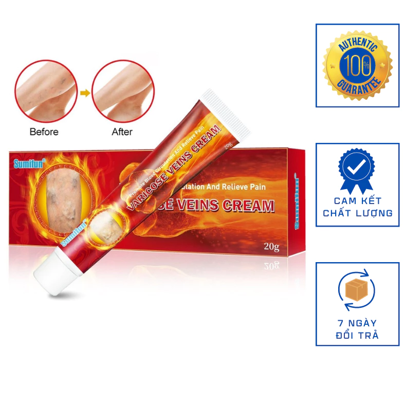 Kem Bôi Suy Giãn Tĩnh Mạch Màu Đỏ Varicose Veins Cream.