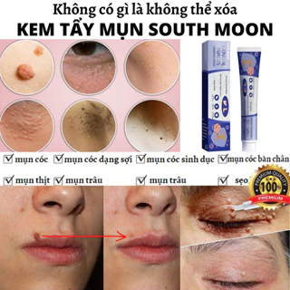 kem tẩy nốt ruồi mụn cóc kem mụn cóc 7 ngày loại bỏ mụn cóc nhanh chóng Loại bỏ mụn cóc an toàn và không đau