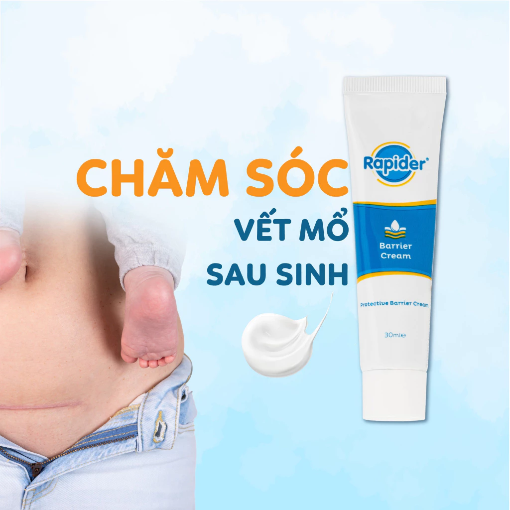 Kem bôi da đa tác dụng Rapider làm lành tổn thương, duy trì độ ẩm, an toàn cho bé 30ml