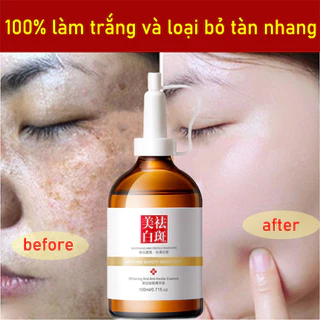 Tinh chất dưỡng serum trắng da tàn nhang kem nám tàn nhang 100ML giảm thâm se khít lỗ chân lông và trắng sáng da