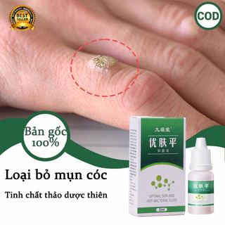 Thuốc mụn cóc Kem loại bỏ mụn cóc Tẩy nốt ruồi 10ml Loại Bỏ Mụn Cóc Và Mụn Thịt Hiệu Quả