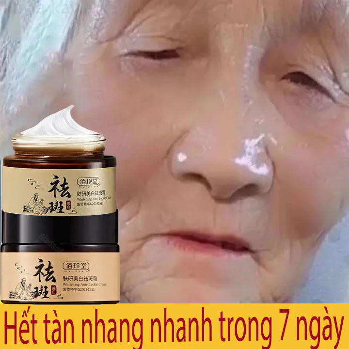 Kem xóa tàn nhang kem xóa nám làm trắng da tinh chất chất làm trắng da mặt và loại bỏ nám làm sáng da chăm sóc 30g kem n