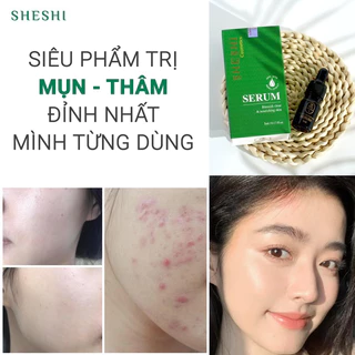 SERUM GIẢM THÂM MỤN SHESHI - dạng lỏng,mùi thơm dễ chịu,ko rít hiệu quả nhanh