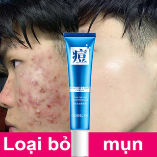 [Loại bỏ mụn trong 3 ngày] Gel loại bỏ mụn,kem loại bỏ mụn nhanh,làm mờ vết mụn một cách hiệu quả,giảm kiểm soát dầu mụn