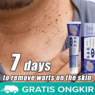 South Moon Wart Removal Cream Tẩy nốt ruồi xóa mụn ruồi trên mặt tàn nhang mụn cóc mụn thịt mụn cơm đánh bật các loại mụ