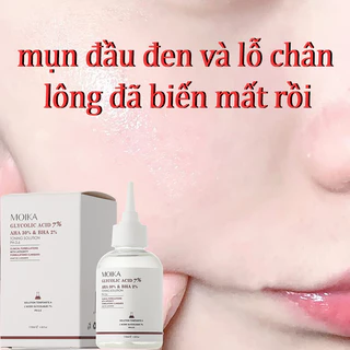 Serum trắng da Serum se khít lỗ chân lông 110ml Làm trắng dưỡng ẩm thu nhỏ lỗ chân lông loại bỏ mụn đầu đen