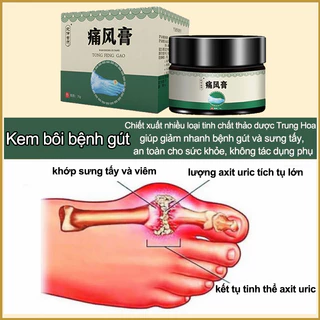 Kem đau khớp Kem bệnh gout giảm nhẹ sưng khớp Hạ axit uric Hòa tan hạt tophi đau đầu gối Giảm sưng Giảm đau 35g