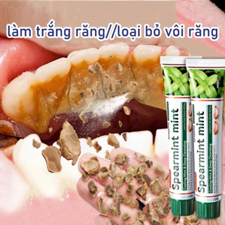 kem đánh răng trắng răng loại bỏ cao răng hôi miệng tẩy ố vàng làm trắng làm sạch răng làm mới hơi thở khử mùi