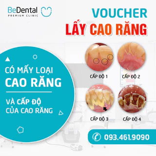 Evoucher - Lấy Cao Răng (Cạo vôi răng) Và Đánh Bóng Công Nghệ Siêu Âm Mới - Nha khoa BeDental (5 chi nhánh)