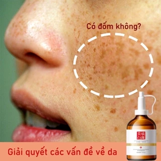 Tinh chất chống tàn nhang 100ml Làm mờ nám làm đều màu da Cân bằng nước và dầu