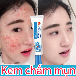 Kem chấm mụn Gel giảm mụn 25g giảm thâm ngăn mụn tái phát kem bôi mụn làm mờ thâm mụn Giảm Sưng Đỏ chăm sóc da mặt