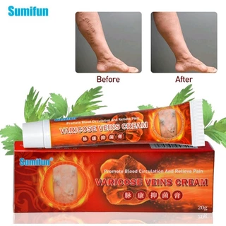 Kem bôi suy giãn tĩnh mạch sumifun 20gr - Kem bôi tĩnh mạch thảo dược hỗ trợ giao nhanh toàn quốc