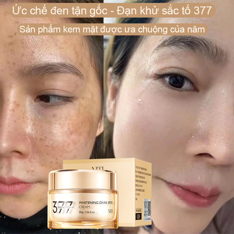 kem xóa nám 30g Kem dưỡng trắng da và xóa tàn nhang Niacinamide làm mờ vết thâm nám tàn nhang xóa vết thâm