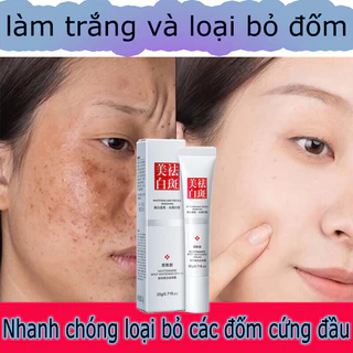 Kem trắng da và xóa tàn nhang Kem nám tàn nhang 20g kem dưỡng trắng da mặt Hiệu quả làm mờ thâm nám tàn nhan se khít lỗ