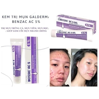 Kem giảm mụn Benzac AC 5% Benzoyl Peroxide - Galderma