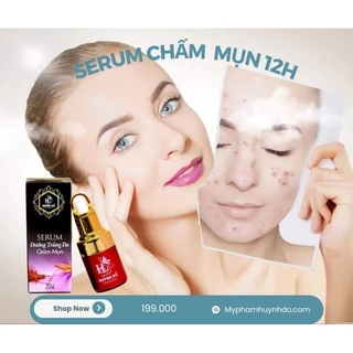 Chấm mụn HUỲNH ĐỖ 20ml, giảm mụn mủ, mụn bọc, mụn đầu đen, mờ thâm