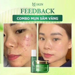 COMBO CAO MỤN  SÂM VÀNG KẾT HỢP SỮA RỬA MẶT  NHÂN SÂM