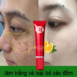 Kem diệt tàn nhang  ngừa nám Chuyên sâu Loại bỏ các đốm đen Sắc tố làm sáng da Chăm  Tự nhiên/whitening freckle cream