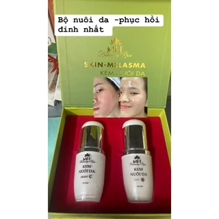 Bộ nuôi da MH Spa ⚡ MẪU MỚI ⚡ tinh chất dưỡng da trắng sáng đều màu, thu nhỏ lỗ chân lông hiệu quả