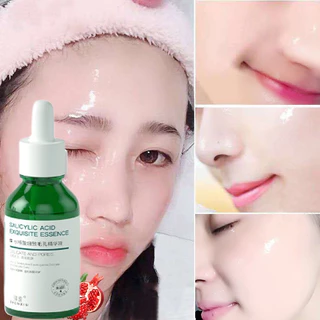 Serum se khít lỗ chân lông Serum trắng da Lột mụn đầu đen Trắng da mặt Se khít lỗ chân lông 30ML