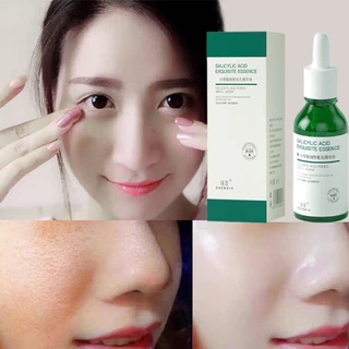 Serum se khít lỗ chân lông Sâu Thu Nhỏ Lỗ Chân Lông Làm Sáng Da Da Săn Chắc Mịn Màng Dưỡng Ẩm 30ml salicylic