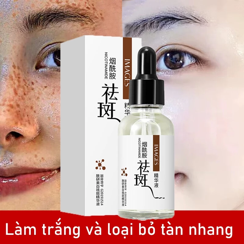 serum nám tàn nhang Tinh chất làm trắng sạch tàn nhang serum trắng da Loại bỏ đồi mồi nám hỗn hợp thâm mụn hắc tố