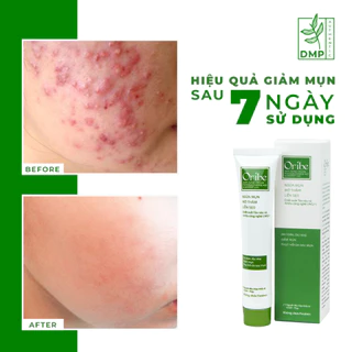 Kem Giảm Mụn Ẩn, Thâm, Đầu Đen Cho Da Dầu Mụn Giúp Mờ Sẹo Mụn Oribe 20g