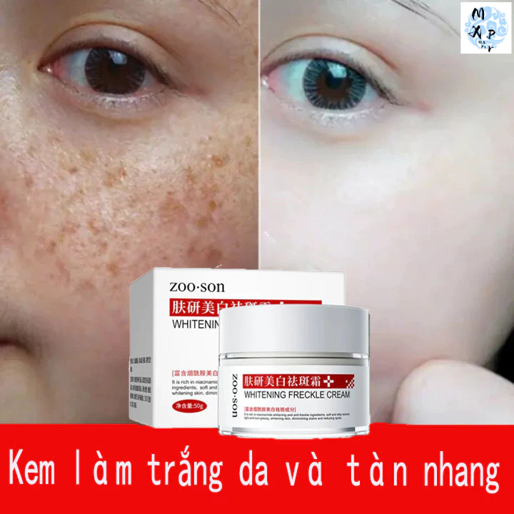 👍Loại bỏ tàn nhang nhanh chóng👍  Kem Dưỡng Trắng Da Mặt Trung Hoa Loại Bỏ Tàn Nhang Và Đốm Đen 50g