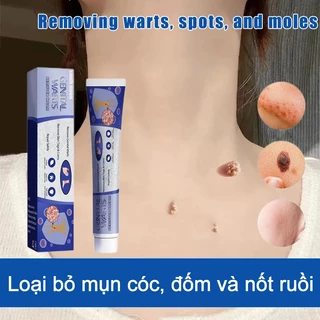 kem bôi rụng hết sạch mụn thịt thừa, mụn cóc, mụn nốt duồi và các mụn li ti quanh mắt