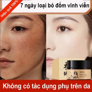 （Làm trắng vĩnh viễn）Kem làm trắng da mặt giảm nếp nhăn tăng cường độ đàn hồi của da làm sáng màu da ngăn ngừa lão hóa