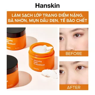 Sáp Tẩy Trang Dành Cho Da Khô, Da Thường HANSKIN PORE CLEANSING BALM AHA 80g