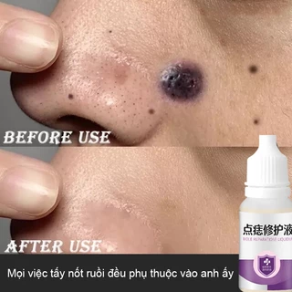 Wart Removal Cream Loại bỏ nốt ruồi Mụn ruồi đen Nhanh chóng loại bỏ nốt ruồi trong 7 ngày Xóa nốt ruồi hiệu quả 10ml