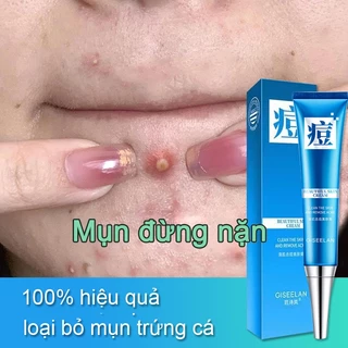 【Mua 2 tặng 1】Kiểm soát dầu và mụn Se khít lỗ chân lông Giảm mụn trứng cá Gel mụn kem sẹo sẹo mụn Kiểm soát dầu và mụn