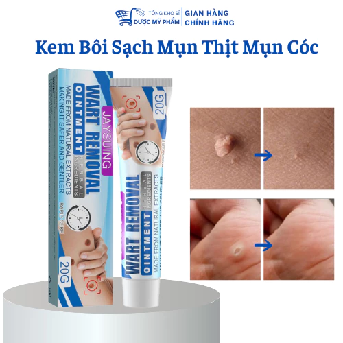 ( bán chạy) kem bôi rụng hết sạch mụn thịt thừa, mụn cóc, mụn nốt duồi và các mụn li ti quanh mắt