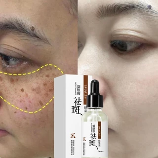 Tinh chất làm trắng sạch tàn nhang tàn nhang serum nám tàn nhang  Hiệu quả làm mờ thâm nám tàn nha