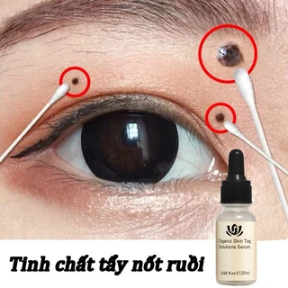 kem mụn cóc kem tẩy nốt ruồi,Skin Tag Remover mole removal serum Mụn Cóc Mụn tẩy nốt ruồi trên mặt an toàn và không đau