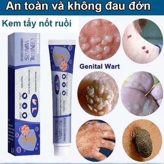 mụn cóc kem loại bỏ mụn cóc loại bỏ nốt ruồi sạch loại bỏ mụn cóc nhanh chóng Loại bỏ mụn cóc an toàn và không đau