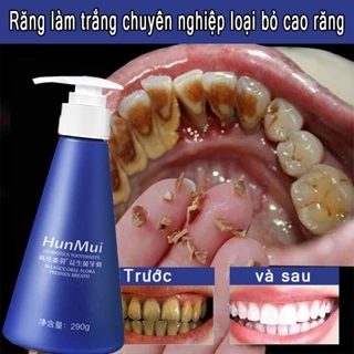 Kem đánh răng làm trắng răng Làm sạch mảng bám Giảm Ố Vàng Hết Hôi Miệng loại bỏ cao răng hôi