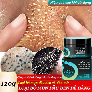 Mặt nạ mặt nạ dưỡng trắng da lột mụn đầu đen 120g Làm sạch sâu Thu nhỏ lỗ chân lông Dưỡng Ẩm Kiểm Soát Dầu