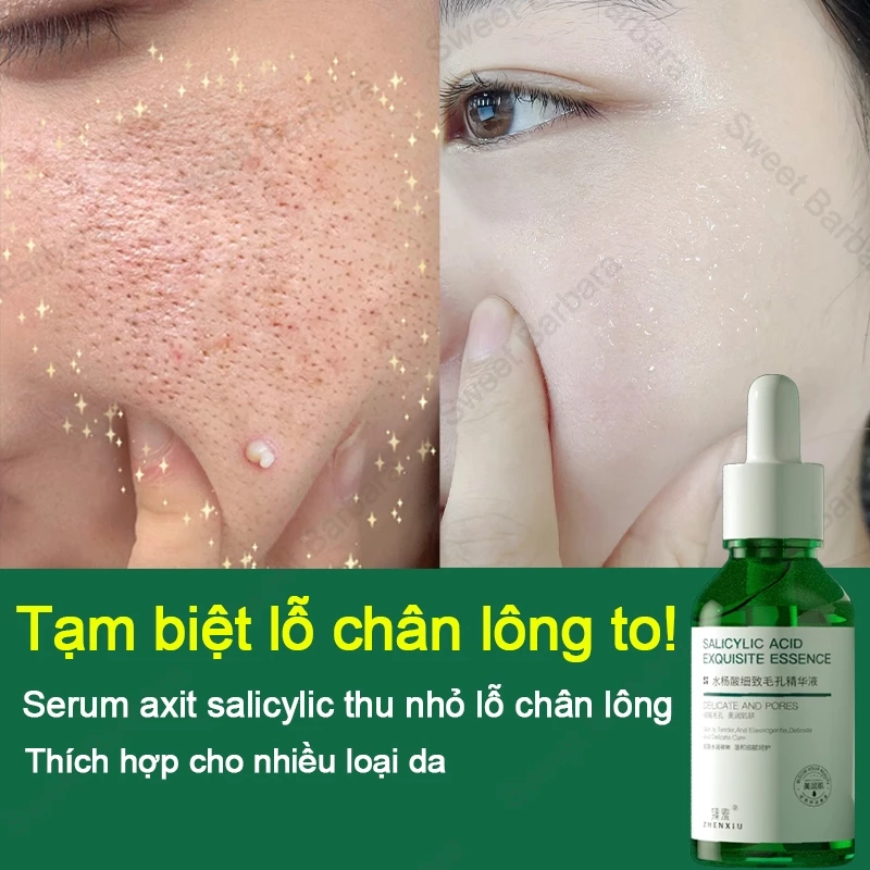 Serum se khít lỗ chân lông 30ml Tinh Chất Salicylic Acid Thu nhỏ lỗ chân lông Giảm mụn đầu đen Dưỡng ẩm và làm trắng da