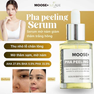 Peel da moose cải thiện lỗ chân lông sạm nám trọng lượng 30ml hạn dùng 2026