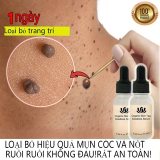 kem loại bỏ nốt ruồi mụn, loại bỏ mụn cóc ở da, Tẩy nốt ruồi, mắt cá hiệu quả tàn nhang ruồi xóa mụn ruồi trên mặt tàn