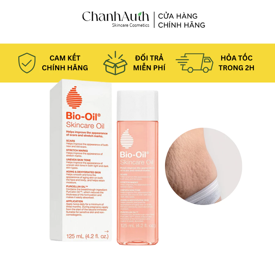 Tinh dầu chống rạn da bà bầu Bio oil hết rạn da mờ sẹo hết thâm da trong quá trình mang thai và sau sinh