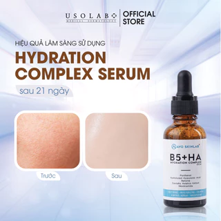 Serum ha b5 USOLAB AVO tái tạo, phục hồi da, tăng đàn hồi, da căng bóng