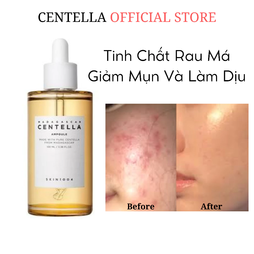 Tinh Chất Rau Má Giảm Mụn Và Làm Dịu Dành Cho Da Nhạy Cảm Skin1004 Madagascar Centella Ampoule 100ml