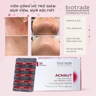 Uống hỗ trợ làm đẹp da Biotrade Acne out